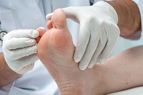 O médico examina os pés en busca de fungos nos dedos dos pés